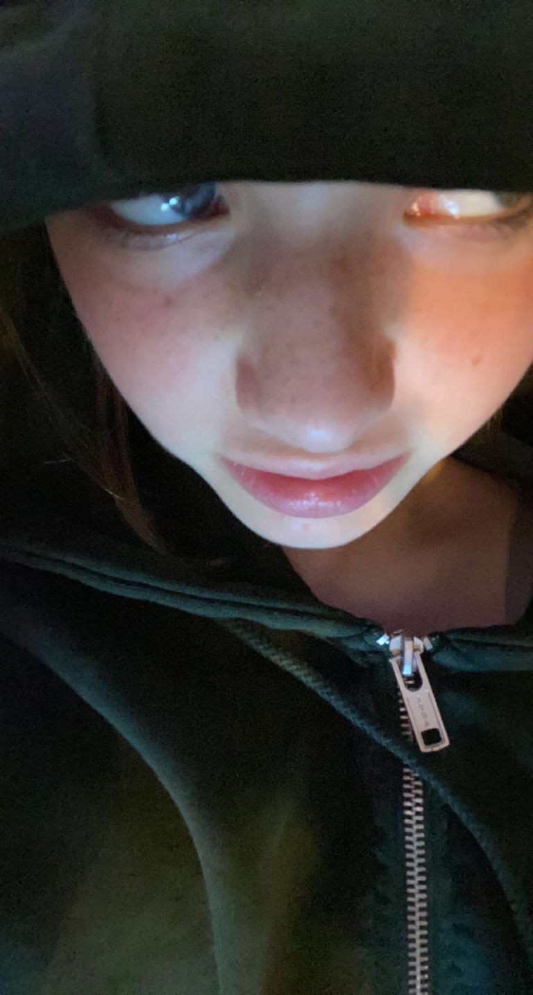 Anatomy of a Loss (2)